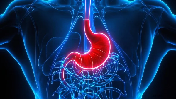 反流性食管炎：一种常见但易被忽视的消化疾病