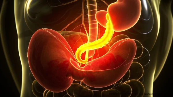 全面解析急性阑尾炎:从诊断到治疗