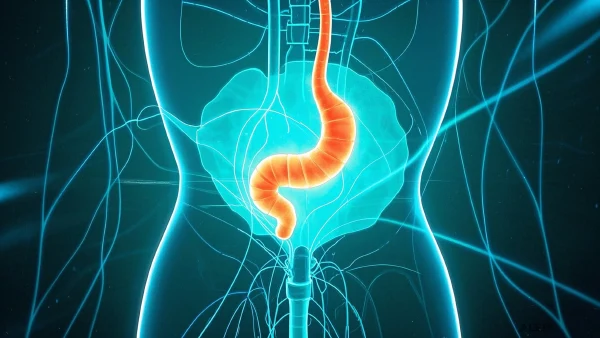 慢性肚子疼？警惕阑尾炎的三大信号