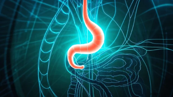 揭开急性坏疽性阑尾炎的面纱：科学预防与合理治疗