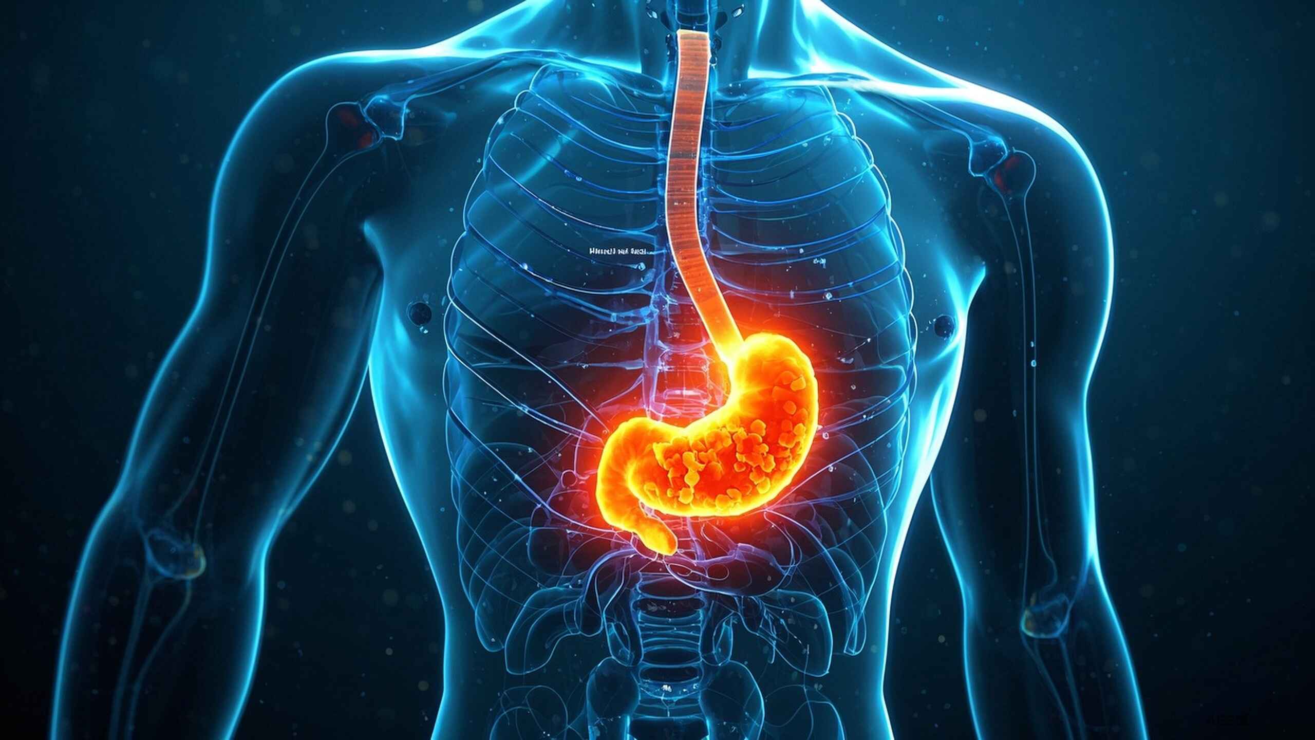 科普，胃癌，你必须知道的健康风险与应对策略🩺封面图