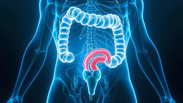 乙状结肠癌：病因剖析、分期解读与治疗全面指南