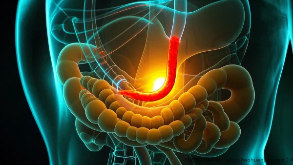 急性阑尾炎:诊断与管理全面解析
