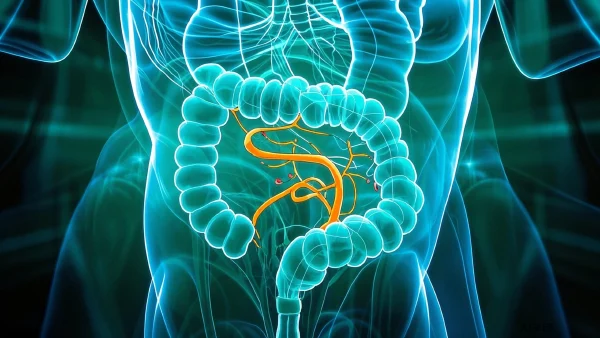 结肠息肉的全面解析：预防与治疗策略