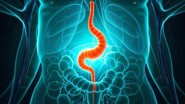 急性化脓性阑尾炎伴局限性腹膜炎的临床特点与治疗策略