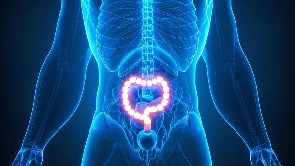 乙状结肠癌:如何识别风险与科学管理健康
