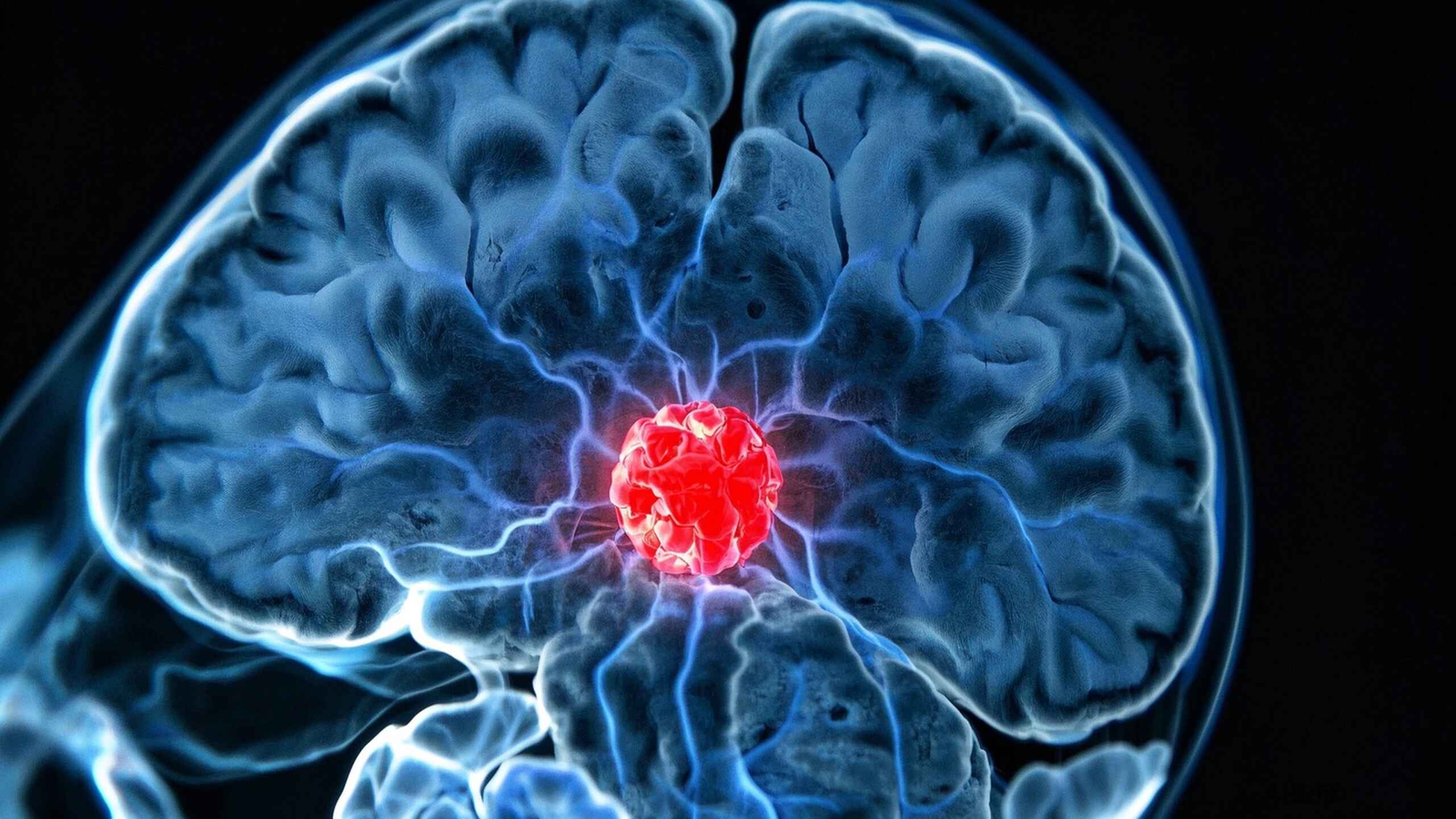 科普，揭开<span style="color: #da4707">脑肿瘤</span>的神秘面纱：通过MRI窥探<span style="color: #da4707">病理</span>之谜