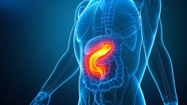 直肠癌：识别症状、了解病因与科学应对