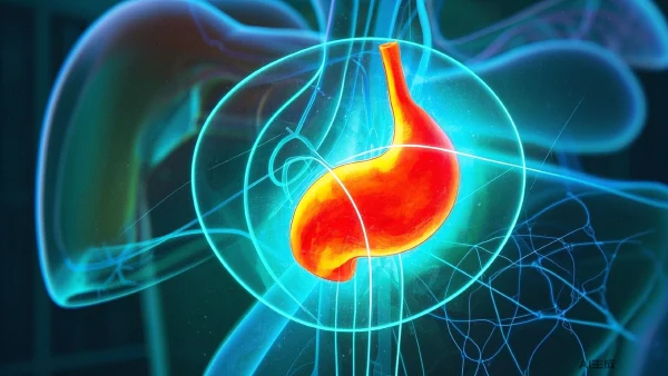 胆囊结石及急性胆囊炎:诊疗与健康管理的多维视角