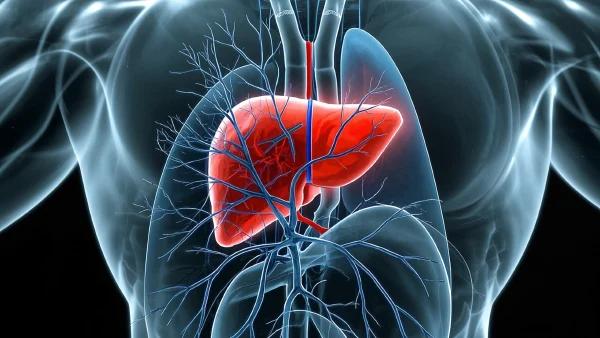 肝胆管结石与肝脏病变——一场不容忽视的健康危机!