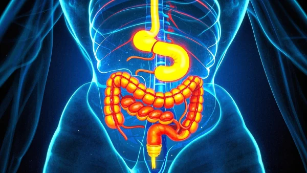 探索溃疡性结肠炎:治疗与生活指南