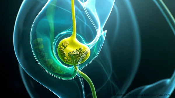 :胆总管结石：小小石头，大大隐患