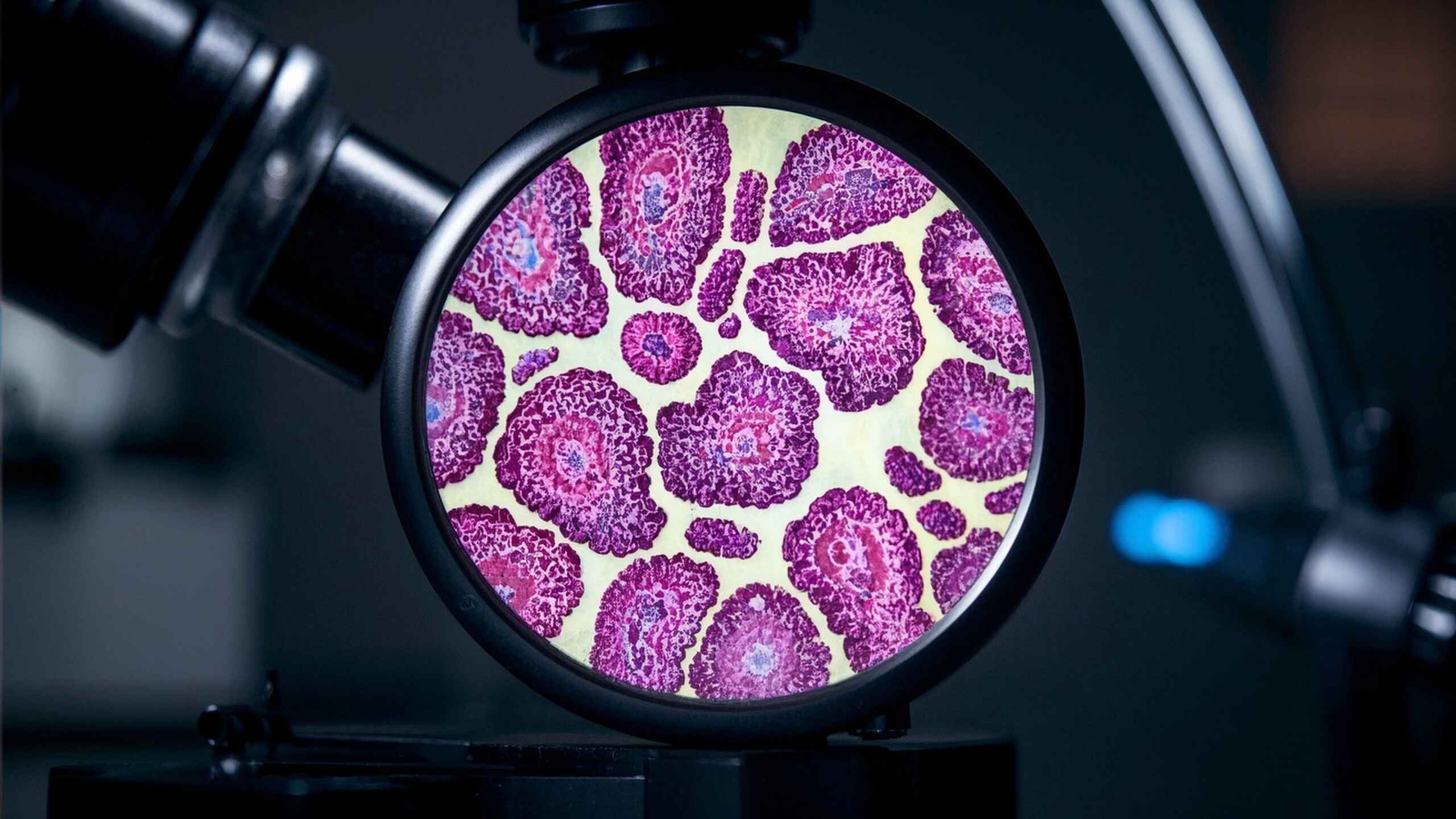 科普，揭开肿瘤病理诊断的神秘面纱：从细胞到<span style="color: #da4707">分子</span>