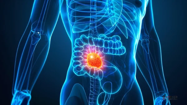 深入了解溃疡性结肠炎，守护你的消化健康