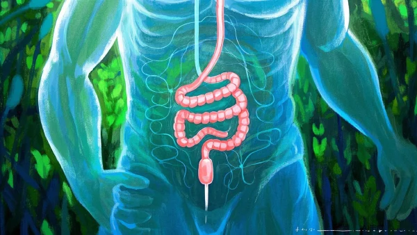 探索乙状结肠癌:早期筛查与个体化治疗的全科医疗策略