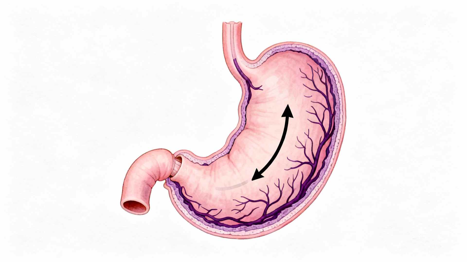 科普，消化道出血<span style="color: #da4707">急救</span>用药双剑合璧：关键抗菌<span style="color: #da4707">方案</span>全攻略