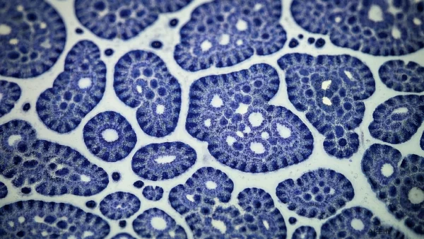 胰腺钙化：潜伏在体内的健康危机与早期识别