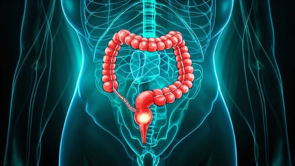 结肠息肉手术麻醉，全麻还是局麻？