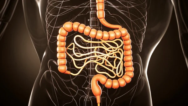 全面解析肠穿孔及其相关并发症:诊断、分期与治疗