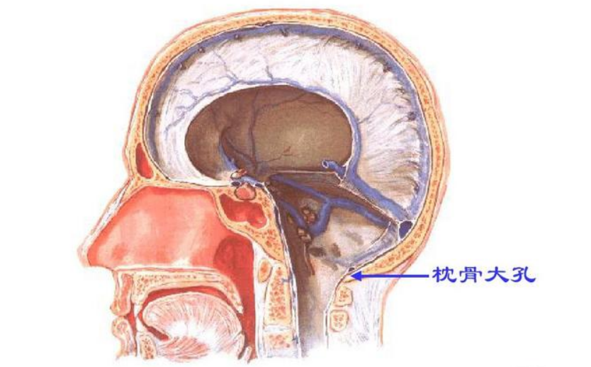 揭秘枕骨大孔病变：影响生活质量的隐匿病症