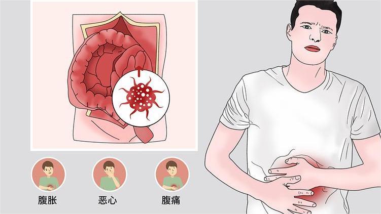 家庭护理注意事项，预防腹部肿瘤患者术后并发症