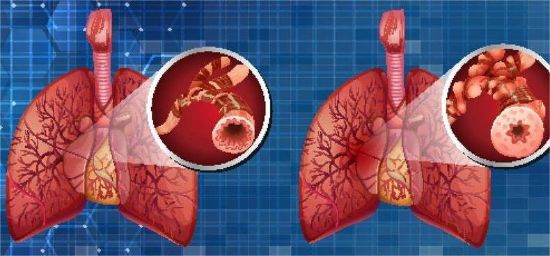 慢性阻塞性肺病（COPD）：从病因到治疗的全面解读